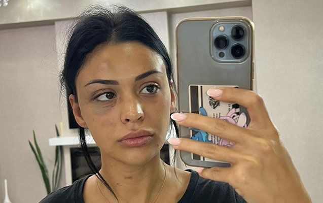 “Məni ölümünə döyürdü, bıçaqla işgəncə verirdi” - FOTOLAR
