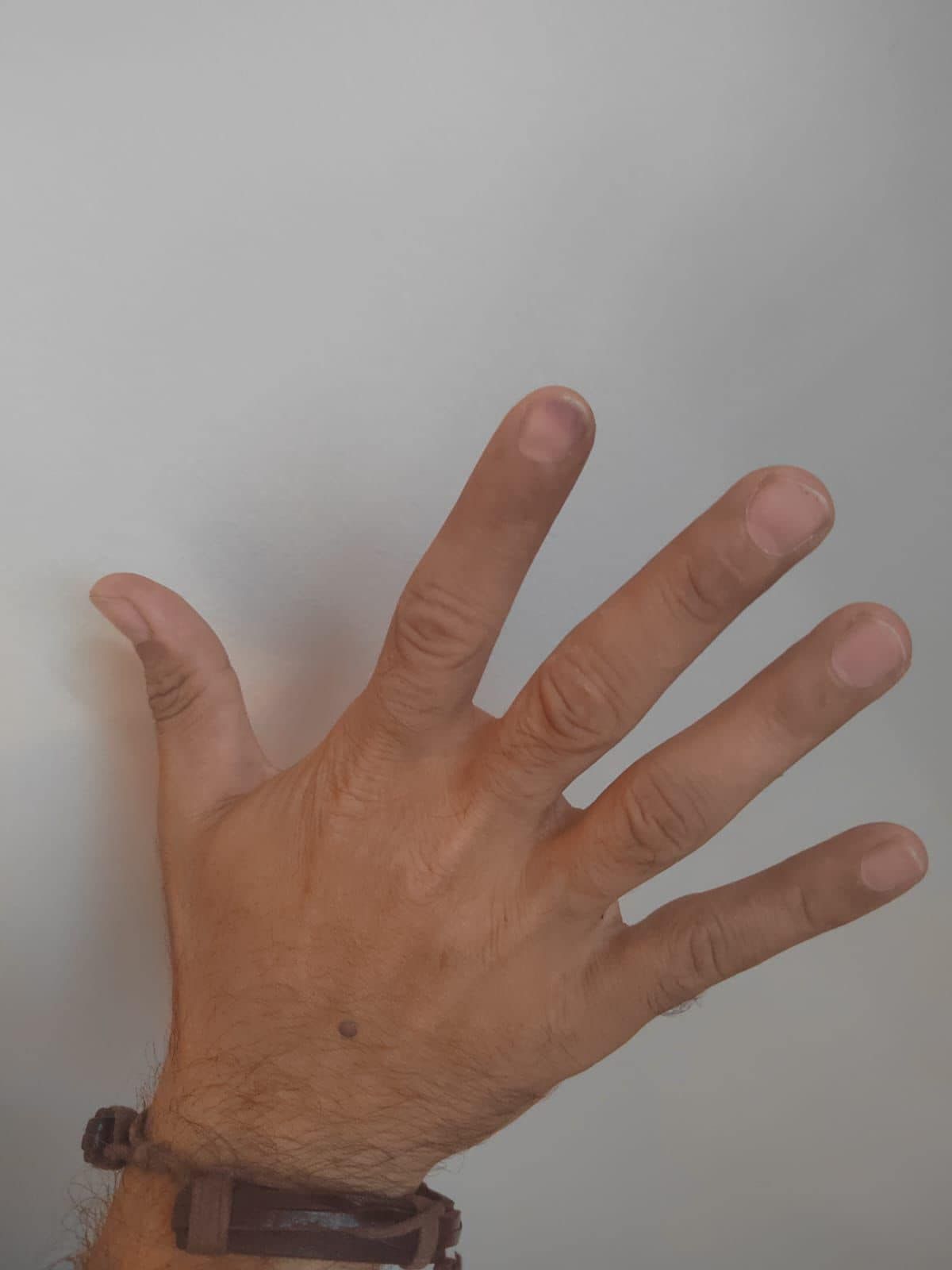Vəfa Nağının şillələdiyi vəkili bu dəfə döydülər - FOTO Vəfa Nağının şillələdiyi vəkili bu dəfə döydülər - FOTO