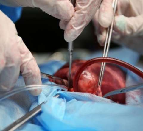 Orqan alverinə qarşı konvensiyaya qoşulan 16-cı ölkə – Xəstə sayı donorlardan 6 dəfə çoxdur 