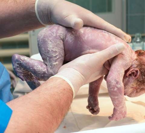 Ölü doğulan uşağın zirzəmiyə atılması iddiası ilə bağlı  klinikadan açıqlama