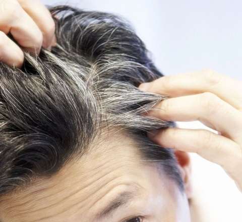 Kişilərdə saç tökülməsinə SON: Yeni vasitə hazırlandı 