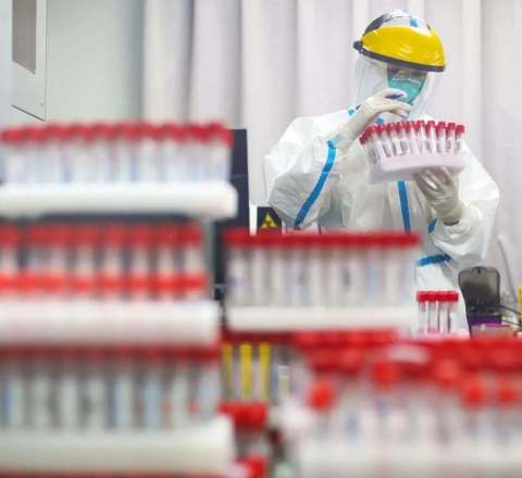 Efiopiyada təhlükəli virus yayıldı 