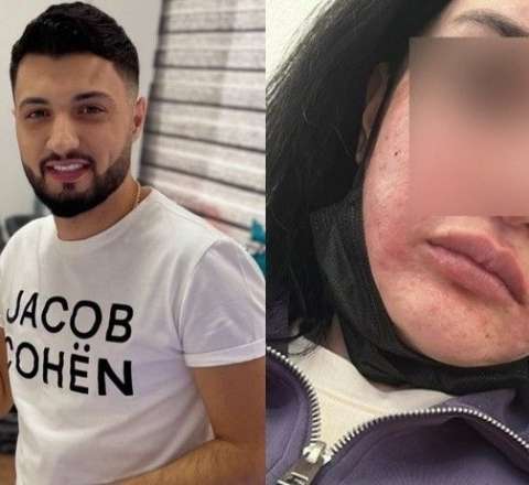 "Dedilər ki, üzümü bu hala qoyan Əmrah həkim yox, bərbərdir" 