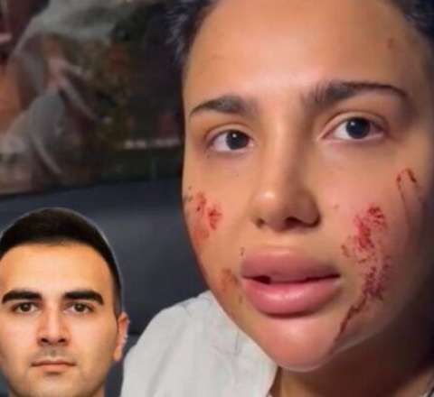 Bakıda sevdiyi oğlandan ayrılan qadına bıçaqlı hücum oldu - VİDEO 