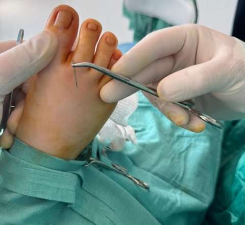 İynə uşağın ayağından 14 gün sonra çıxarıldı - FOTOLAR