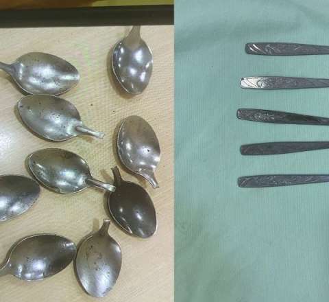 Bakıda 9 ədəd qaşıq udan şəxslə bağlı  YENİ DETALLAR