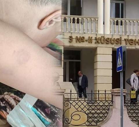 Müəllim autizmli uşağı DÖYDÜ -  Rəsmi AÇIQLAMA - FOTO
