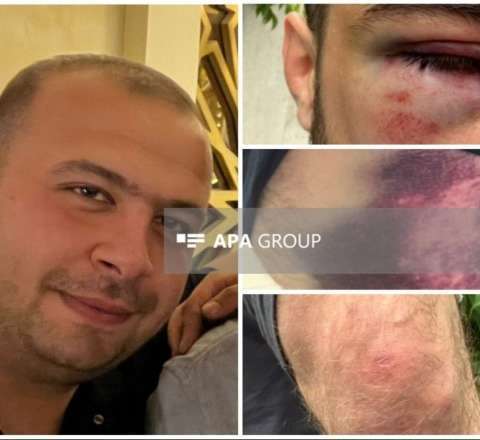 Yekaterinburqda işgəncələrə məruz qalan Vüqar Səfərov: “QAZel”in içindəki palçığı bizə yedizdirmək istəyirdilər -FOTO 