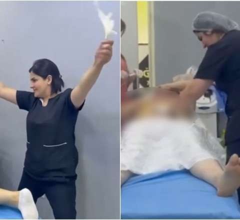 Əməliyyat masasındakı qadının lüt görüntüsünü paylaşan "həkim"lə bağlı araşdırma BAŞLANILDI 