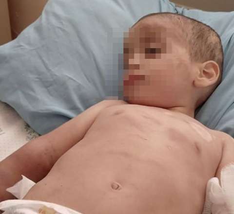 Ağdamda iki yaşlı uşaq döyülüb - Atası saxlanıldı 