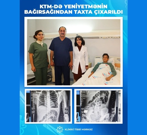 Bakıda 17 yaşlı gənc taxta parçaları uddu 