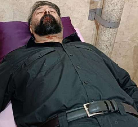 Kərim İsmayılzadənin vəziyyəti ağırdır – Elektroşokla işgəncə verilib 