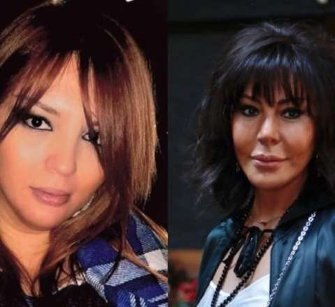 Əri müğənninin qabırğasını sındırıb? - "Həyatda hər şey ola bilər" – AÇIQLAMA 