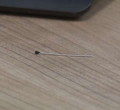 2 yaşlı uşağın bağırsağında iynə tapıldı -  FOTO