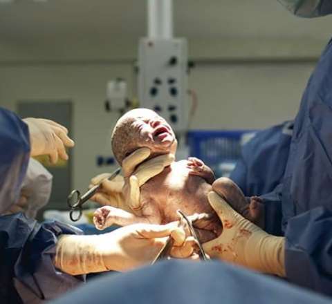 Ana doğuş zamanı öldü, körpəsi sağ qaldı – “Yeni Klinikada” faciə 