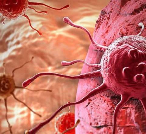 Xərçəng Azərbaycanda əl-qolunu açır: hansı tədbirlər görülməlidir? 