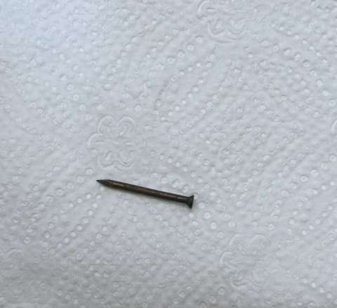 Bakıda azyaşlının mədəsindən mismar çıxarıldı - FOTO 