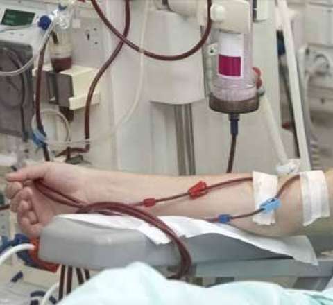 “Yeni hemodializ şöbələri yaradılacaq” 