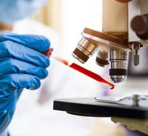 Hərəkətsizlik xərçəng riskini artırırmı? 