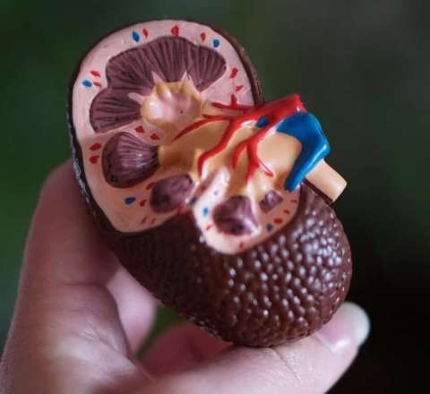 Tibbdə ilk – Böyrək daşlarının tərkibində bakteriyalar tapıldı 