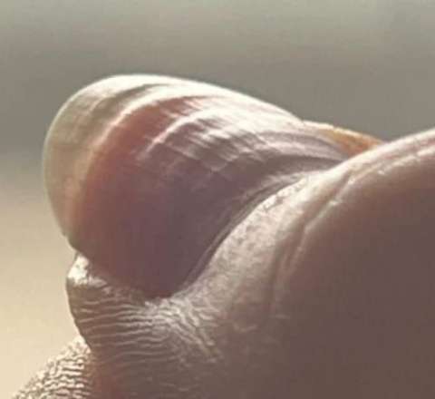 Dalğalı dırnaqlar görün nəyi göstərir -  Bədən həyəcan siqnalı verir