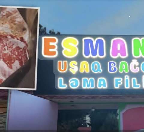 Bağça qalmaqalı: Uşağımın nə yediyini gördüm, məni ağlamaq tutdu 