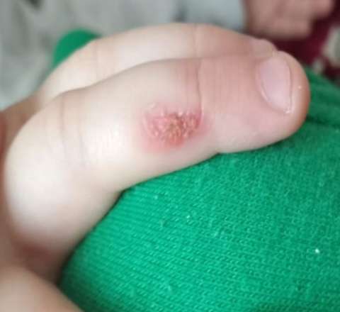 Bağça müəllimi bıçağı qızdırıb 3 yaşlı uşağın əlinə basıb? - VİDEO