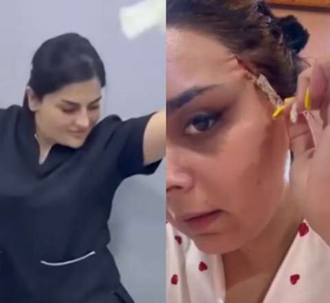 “Dr. Gülü” daha bir pasiyenti yarıcan qoyub? -  VİDEO