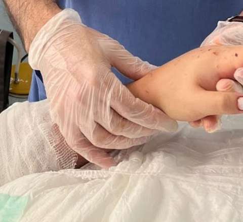 Bakıda 29 yaşlı qadının qopmuş qolu bərpa olundu - FOTO