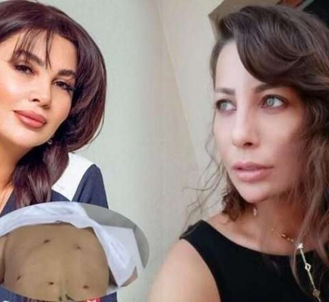 Aktrisaya görə Ülviyyə İlyasovanın cəzası artırıldı 