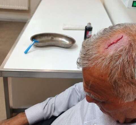 Şəkidə icra nümayəndəsi sədrin başına butulka çırpdı - FOTO