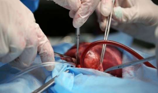Orqan alverinə qarşı konvensiyaya qoşulan 16-cı ölkə – Xəstə sayı donorlardan 6 dəfə çoxdur 