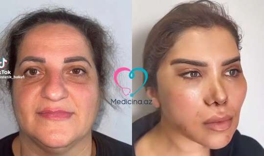 60 yaşlı qadını belə dəyişdilər -  VİDEO