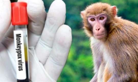 Taylanddan qayıdan turistlərdə meymunçiçəyi    aşkarlandı