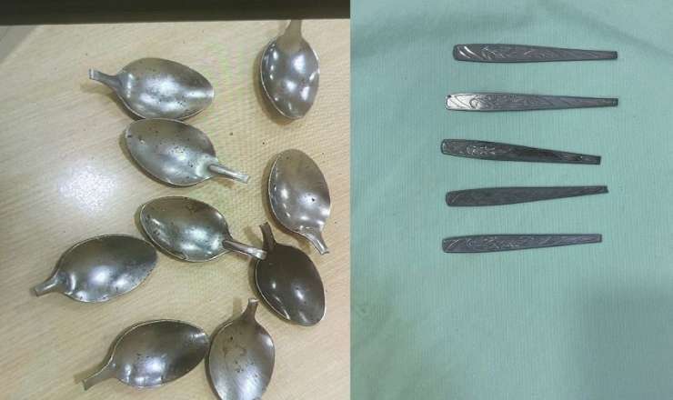 Bakıda 9 ədəd qaşıq udan şəxslə bağlı  YENİ DETALLAR