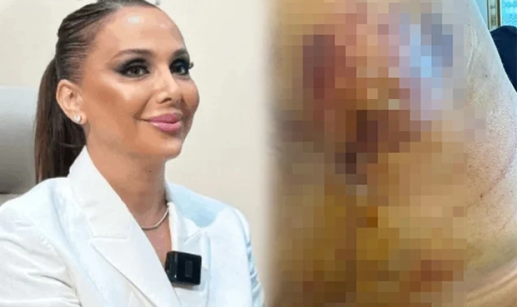 “Həkim məni 3 dəfə əməliyyat edib pis vəziyyətə qoydu” - Daha bir məşhur cərrahdan ŞİKAYƏT