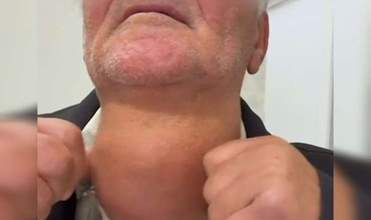 Pasiyentin zobu görənləri təəccübləndirdi -  VİDEO