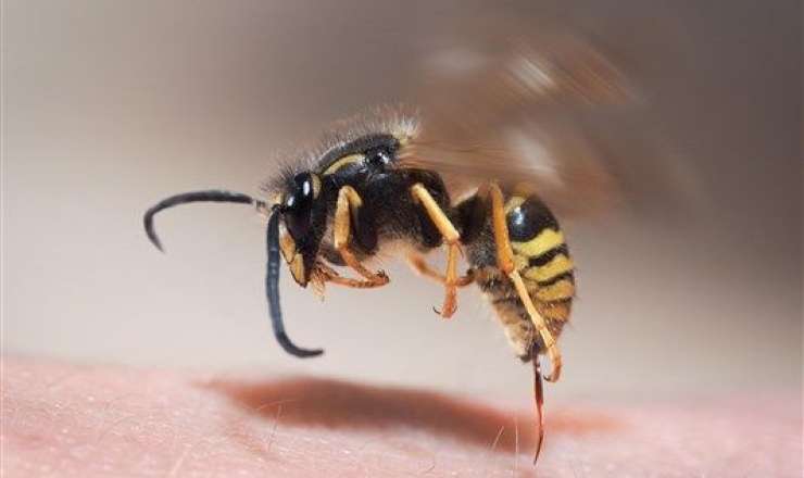 66 yaşlı kişi qızının evində öldü – Arı sancdı 