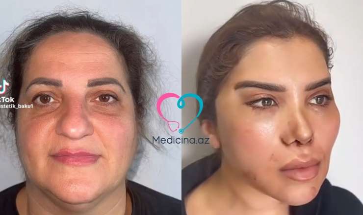 60 yaşlı qadını belə dəyişdilər -  VİDEO