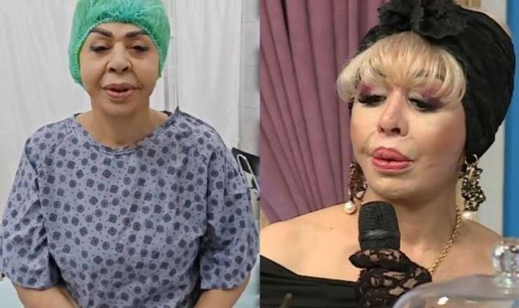 Daha bir müğənni üzünü gərdirdi 