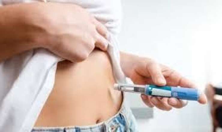 Azərbaycanlı müğənninin arıqlama iynəsindən  gözü tutuldu