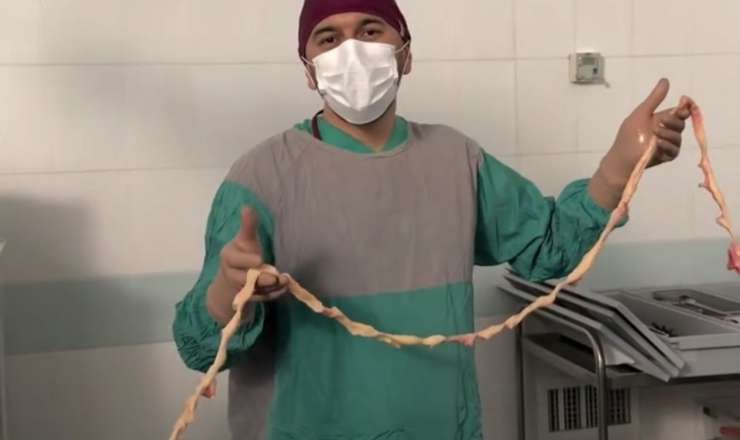 3,5 metr “kista” çıxarıldı – Dünyada ilk ola bilər - VİDEO