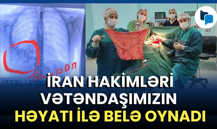  İranın ağciyərdə “göndərdiyi” parça: Bakıda həkimlər şoka düşdü - GÖRÜNTÜLƏR