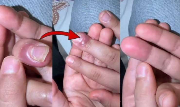 Bu uşaqlar üçün ciddi haldır - valideynlərə XƏBƏRDARLIQ