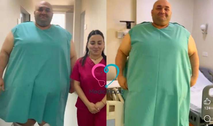 Azərbaycanda 330 kq çəkili kişi     əməliyyat olundu – Video 