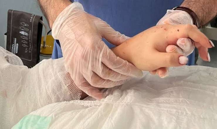 Bakıda 29 yaşlı qadının qopmuş qolu bərpa olundu - FOTO