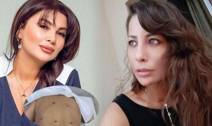 Aktrisaya görə Ülviyyə İlyasovanın cəzası artırıldı 