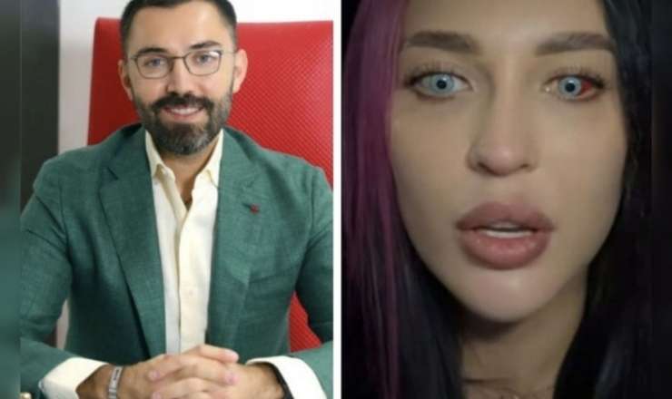 Bakıda göz rəngini dəyişdirdi, görməsi zəiflədi –  Moskvalı qadın peşmandır - VİDEO